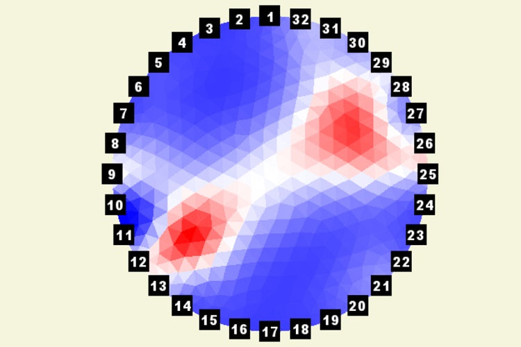 ArborElectro Impedance Tomograph - 0